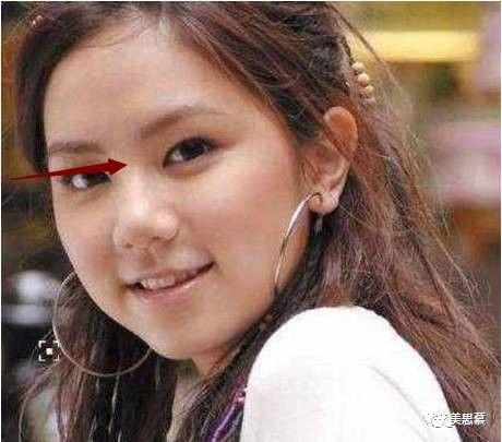 娱乐吃瓜君大鼻子